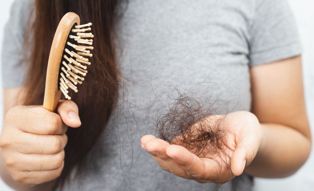 woman losing hair in midlife